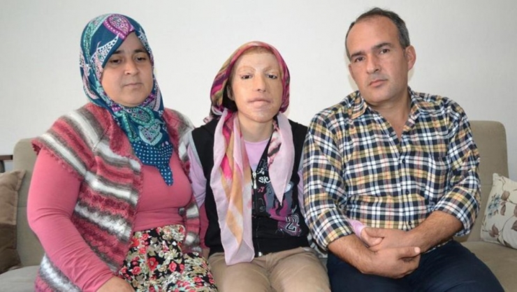 Yeni Bir Yüz Umuduyla Yaşıyor