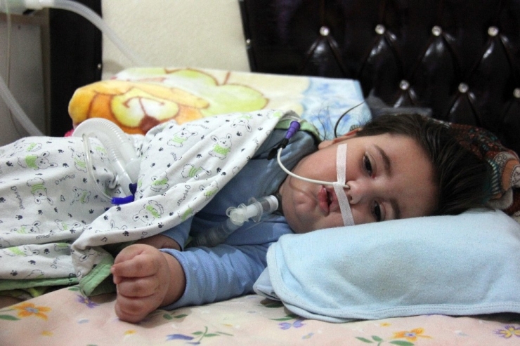 17 Aylık Bebeğin Nefesi Elektriğe Bağlı