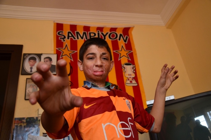 Küçük Hakkı’nın Hayalleri İçin 164 Bin Lira Lazım