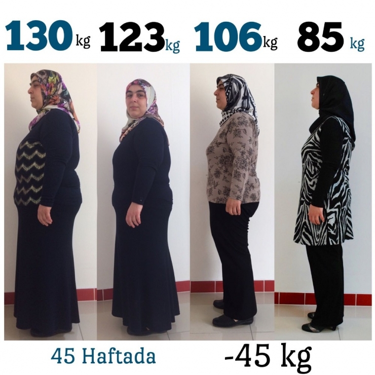 Diyetle 130 Kilodan 85’e Düştü