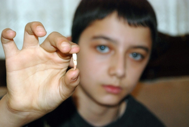 Tokat’ta Süt Dişi Yerine Daimi Dişin Çekildiği İddiası