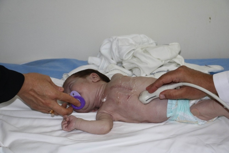 44 Günlük Bebeğin Kalbi Sağda Atıyor