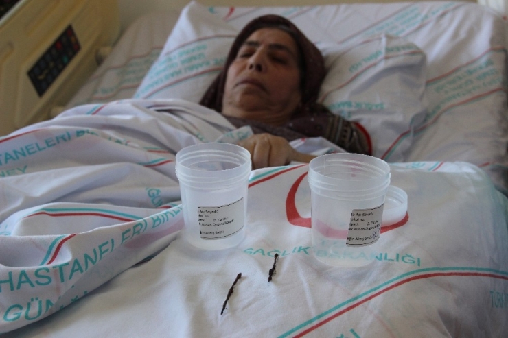 Vücudundaki İğneler 66 Yıl Sonra Çıkarıldı