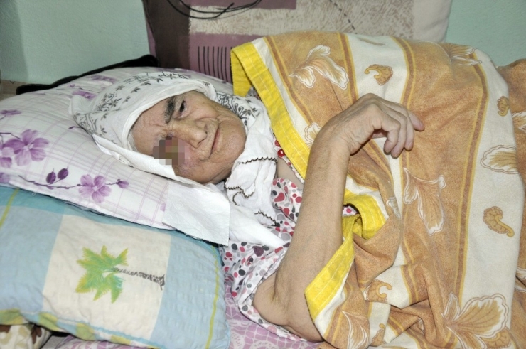 Gözünde Tümör, Vücudunda Kemik Erimesi Var: Evde Bakım Hizmeti İstiyor