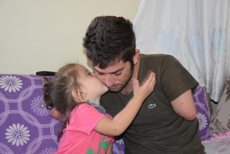 Kolları Ve Ayakları Kopan İşçi Protez İçin Yardım Bekliyor