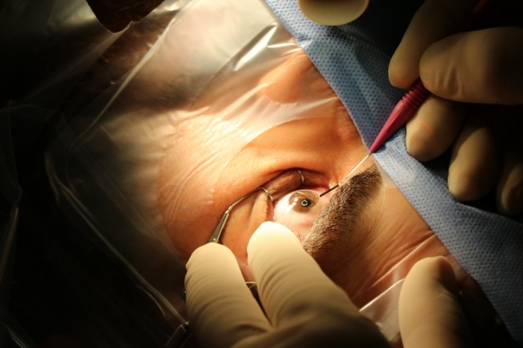 Excimer Lazer İle Gözlüklerden 5 Dakikada Kurtulun