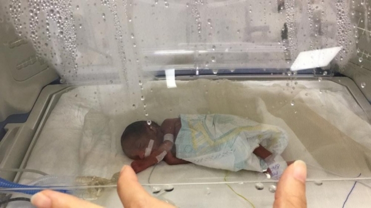 Üç Düşükten Sonra ’Yaşamaz’ Denilen 510 Gramlık Bebekten İyi Haber