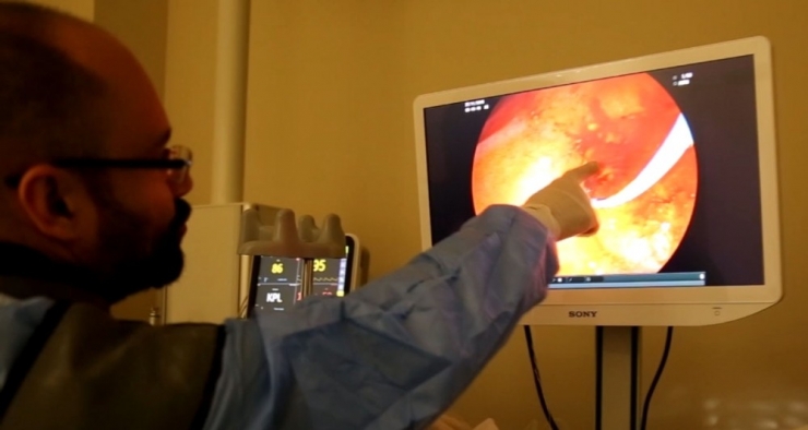 Kayseri Şehir Hastanesi’nden Ercp Hizmeti