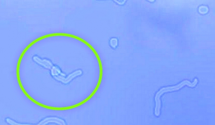 Gözünüzün Önünde Uçuşan Sineklere Dikkat