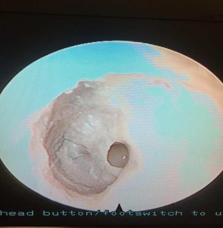 Kulak Zarındaki Delik, Salihli’de Onarıldı