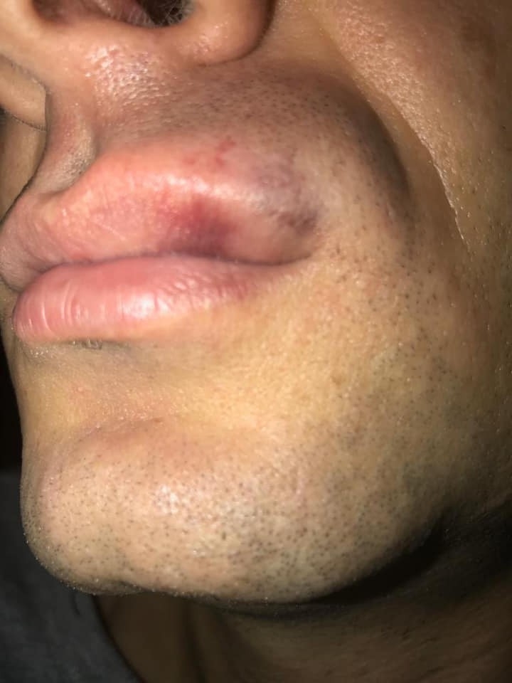 Hakem Camiasından Hakeme Kafa Atan Futbolcuya Tepki