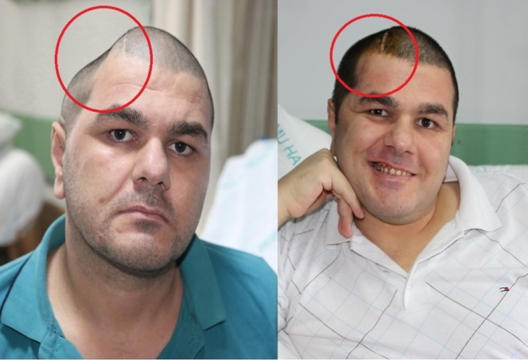 İki Fotoğraf Arasında İnanılmaz Fark