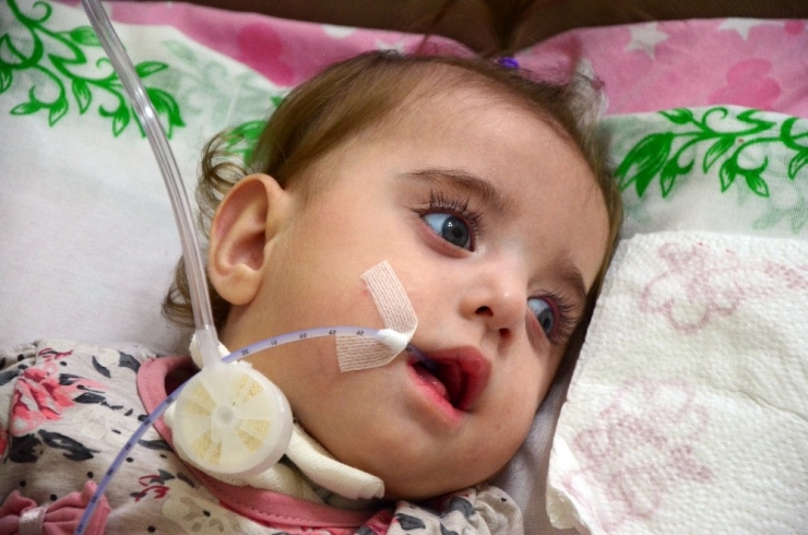 Güneş Bebek "Yutkunabilmek" İçin Yardım Bekliyor