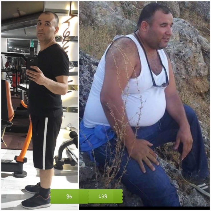 Obezite Hastalarından Doktorlarına Vefa