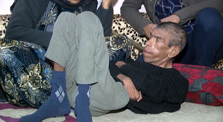 35 Yaşındaki Engelli Oğluna Bebek Gibi Bakıyor