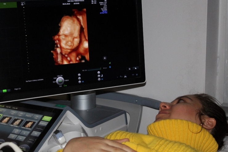 Anne Adaylarına Dört Boyutlu Ultrasonla Perinatoloji Hizmeti