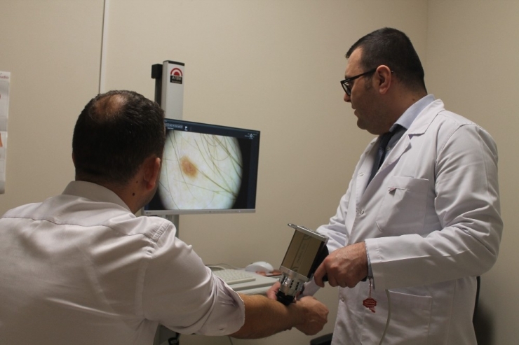 Deri Kanserinde Erken Tanı İmkanı