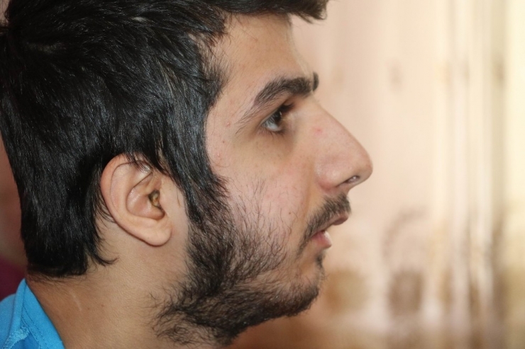 Yanlış Tedavi Yüzünden Çene Gelişimi Durdu