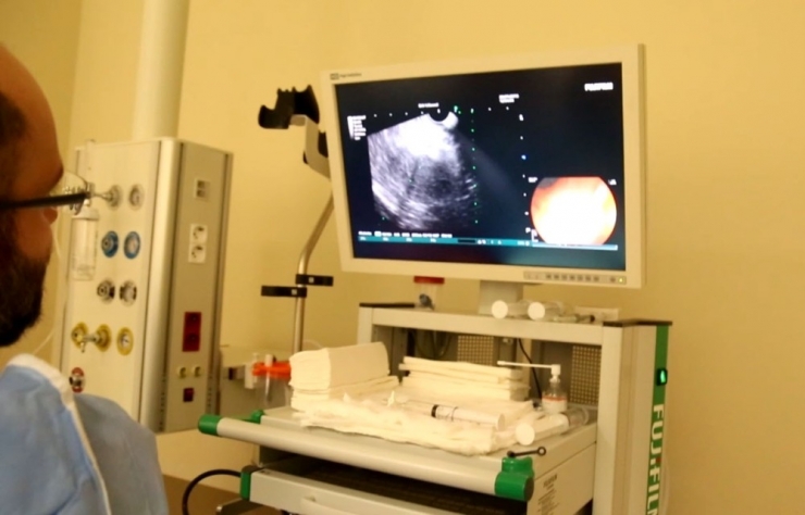 Kayseri Şehir Hastanesinde Eus Yöntemi Kullanılmaya Başlandı