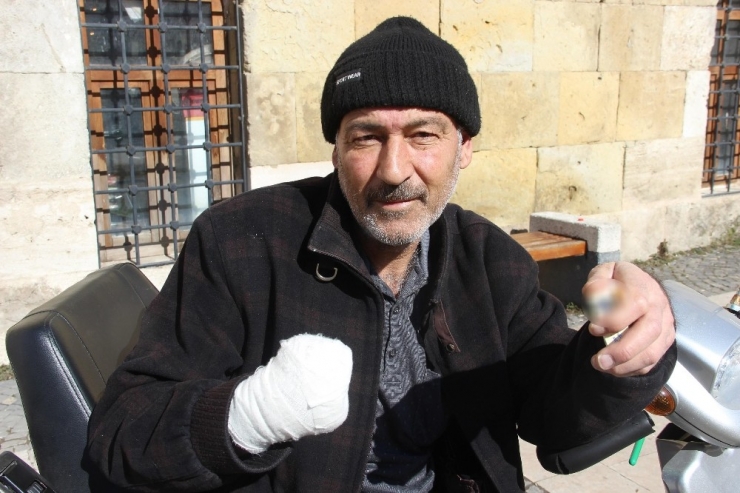 İki Ayağı Ve Bir Kolu Kesildi Yine Sigaradan Vazgeçmedi