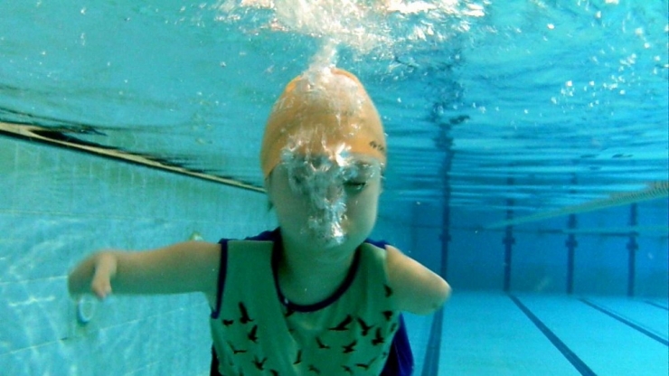 Kolları Yok Ama Kanatları Var