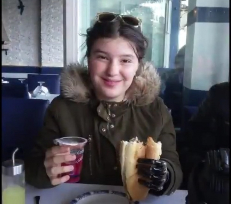 Sol Eli Olmayan Nuriye, Biyonik Eline Kavuşup Haluk Levent’le Düet Yaptı