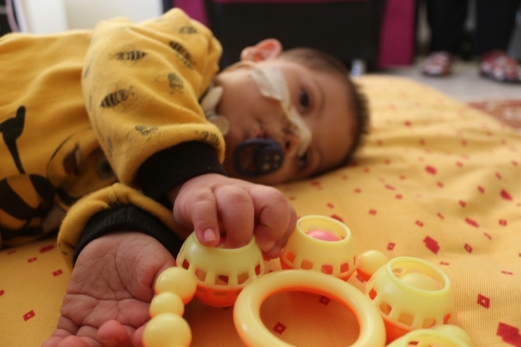 Down Sendromlu Minik Efe Sağlığına Kavuşacağı Günü Bekliyor