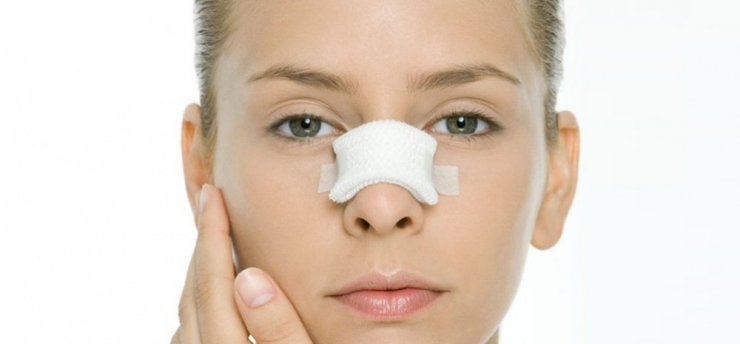 Estetik Burun Ameliyatı Hakkında Merak Edilenler