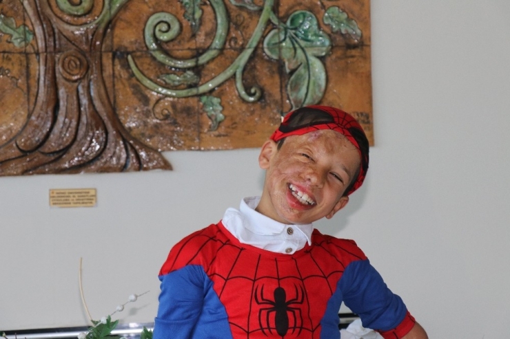 Yüz Nakli Olan Suriyeli Ahmed’in "Örümcek Adam" Hayali