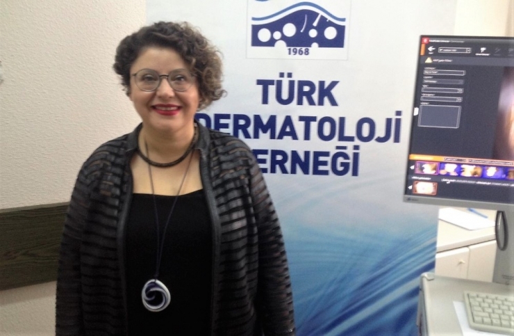 Türk Dermatoloji Derneğinin “Ben Taraması” Hayat Kurtarıyor