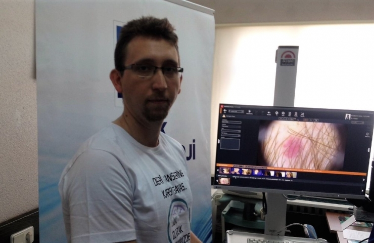 Türk Dermatoloji Derneğinin “Ben Taraması” Hayat Kurtarıyor