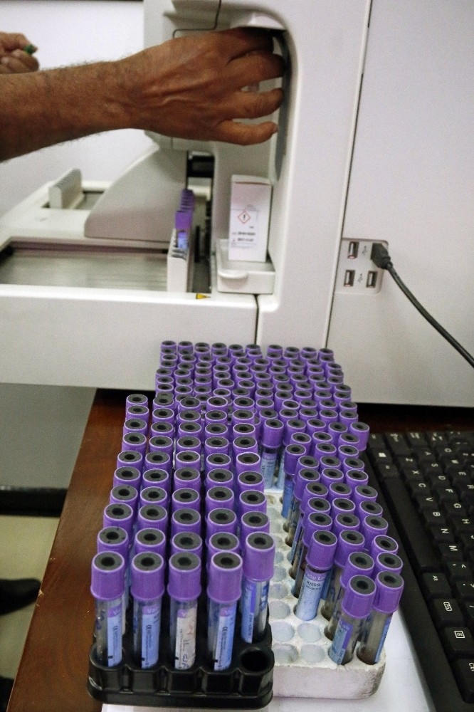 Sri Lanka’da Dang Humması Salgını: 28 Ölü