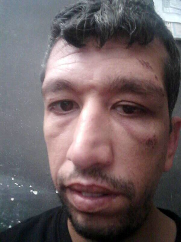 Köpeklerin Saldırısına Uğrayan Genç Bisikletten Düşerek Yaralandı