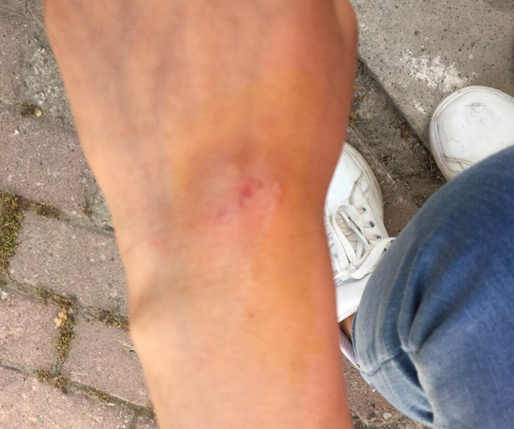 Dilencilerden Genç İletişimcilere Saldırı