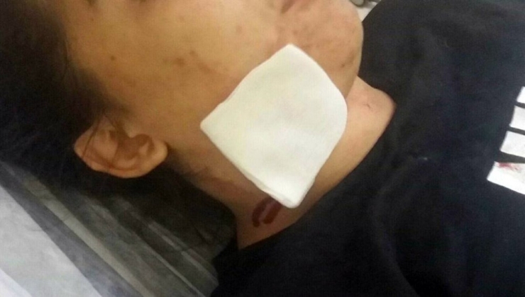 Çenesinden Girip Şah Damarının Yanından Çıktı