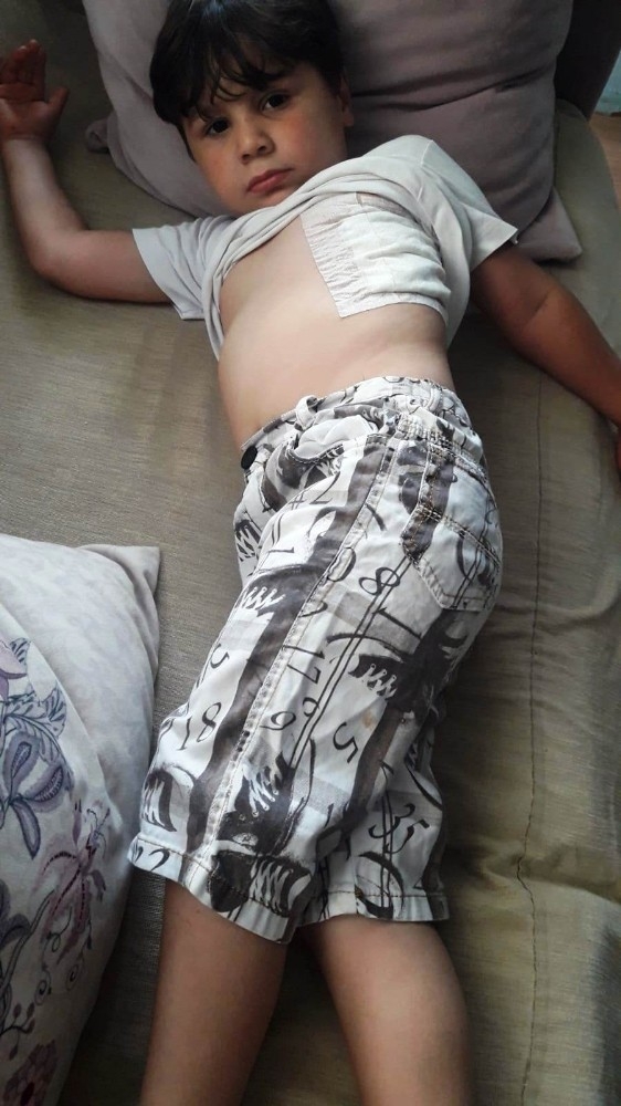 Fatsa’da Köpeğin Saldırısına Uğrayan Çocuk Yaralandı