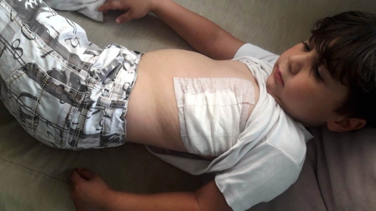 Fatsa’da Köpeğin Saldırısına Uğrayan Çocuk Yaralandı