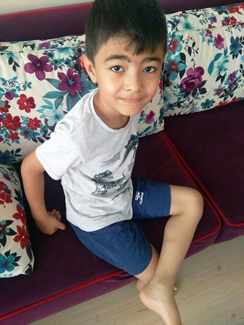 Fatsa’da Köpeğin Saldırısına Uğrayan Çocuk Yaralandı