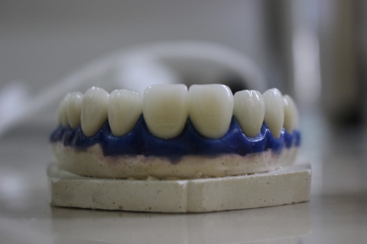 Bir Diş Protezinin Serüveni