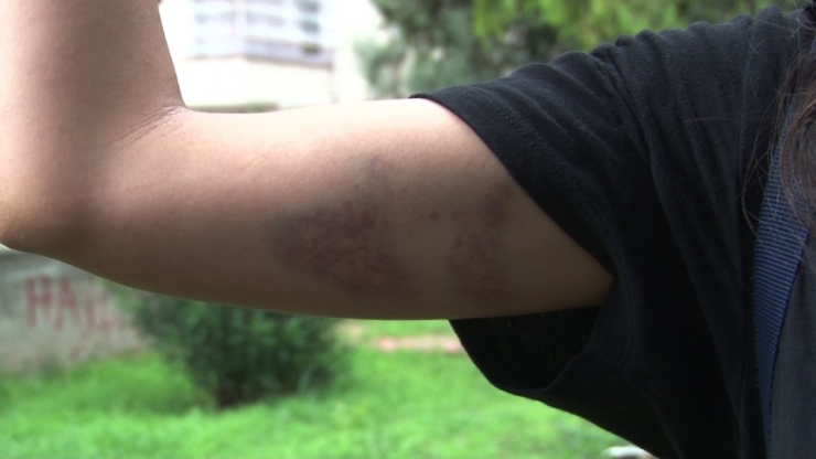 Sokaktaki Kedileri Besleyen Öğretmeni ‘Gösteriş İçin Yapıyorsun’ Diyerek Darp Ettiler