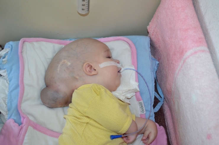 12 Aylık Yunus Emre’nin Yürek Burkan Dramı