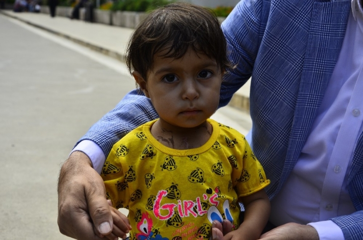 Kalbi Delik Ve Damarları Ters Olan Aye Bebek Türkiye’de Sağlığına Kavuştu