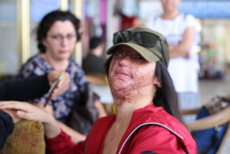 Berfin Özek’in Yüzüne Asit Türünden Bir Sıvı Döken Sanık, İlk Kez Hakim Karşısına Çıktı