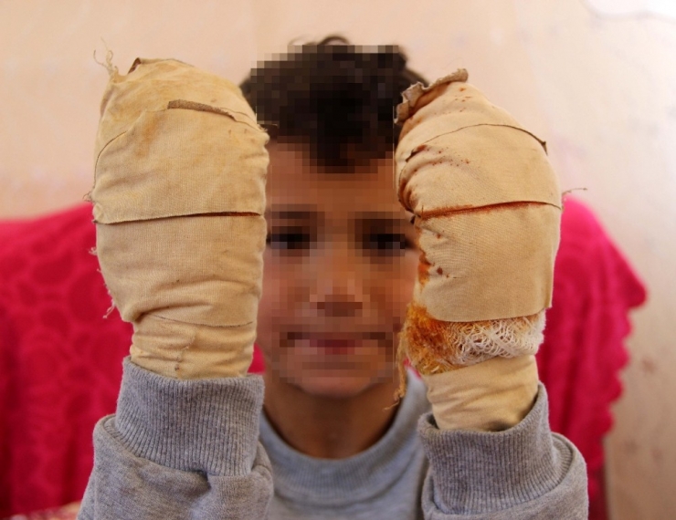 Komşu Çocuğu, Küçük Efe’ye Dehşeti Yaşattı