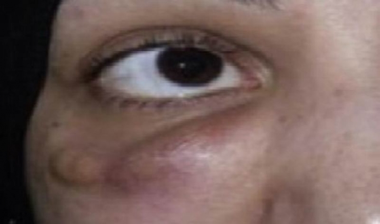 Güzel Olmak İçin Güzelliğinizden Olmayın