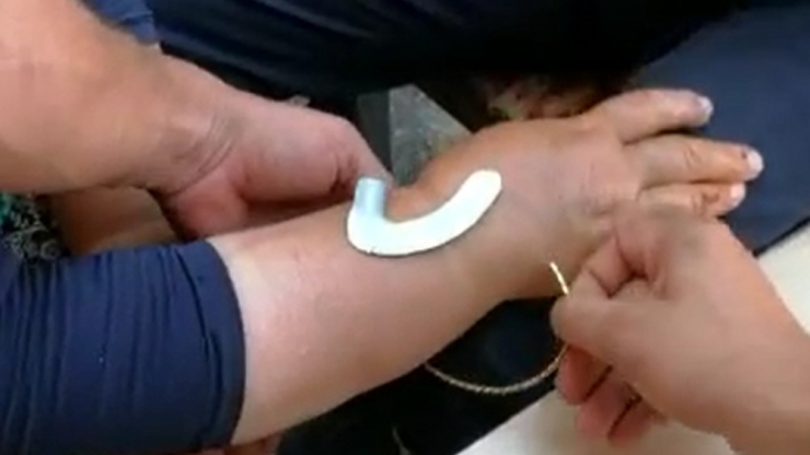 Şişen Bileğindeki Bileziği İtfaiye Çıkardı