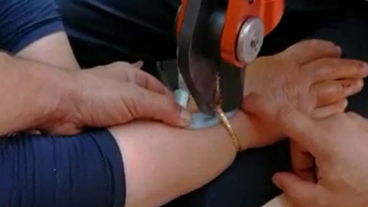 Şişen Bileğindeki Bileziği İtfaiye Çıkardı