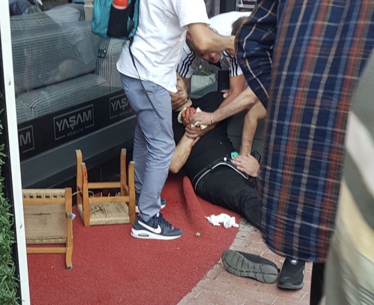 Arkadaşlarıyla Kaldırımda Otururken Pompalı Tüfekle Vuruldu