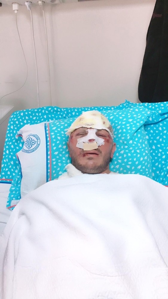 Motosiklet Kaskı Kırık Diye Takmayan Sürücü Dehşeti Yaşadı