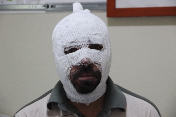 Ardahan’da Ki Taş Ocağında Dehşeti Yaşayan Kişi O Anları Anlattı